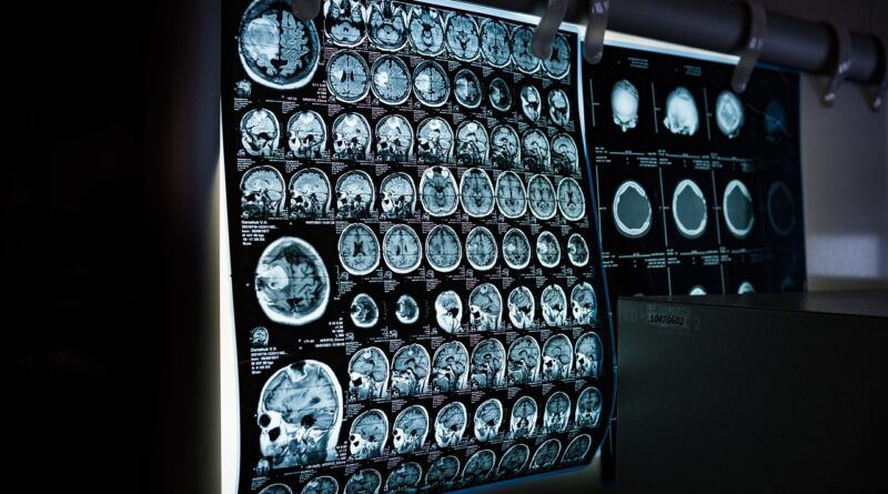 x-ray, mri, ct scan, computed tomography, magnetic resonance imaging, medicine, neurology, healthcare, x-ray, mri, mri, mri, mri, mri, ct scan, medicine, neurology, neurology, healthcare, healthcare