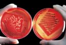agar, breeding ground, red, blood cells, experiment, research, agar agar, agartang, japanese fish glue, edges, china gelatine, japanese gelatine, carrageenan, polysaccharide, galactose polymer, curd, agarose, agaropektin, biology, science, chemistry, scientists, bacteria, cell growth, medical, germs, bacteria, bacteria, bacteria, bacteria, bacteria