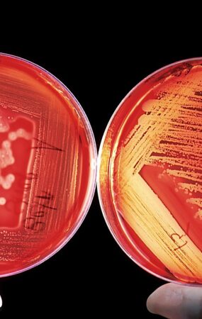 agar, breeding ground, red, blood cells, experiment, research, agar agar, agartang, japanese fish glue, edges, china gelatine, japanese gelatine, carrageenan, polysaccharide, galactose polymer, curd, agarose, agaropektin, biology, science, chemistry, scientists, bacteria, cell growth, medical, germs, bacteria, bacteria, bacteria, bacteria, bacteria