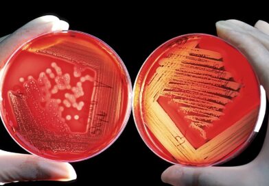 agar, breeding ground, red, blood cells, experiment, research, agar agar, agartang, japanese fish glue, edges, china gelatine, japanese gelatine, carrageenan, polysaccharide, galactose polymer, curd, agarose, agaropektin, biology, science, chemistry, scientists, bacteria, cell growth, medical, germs, bacteria, bacteria, bacteria, bacteria, bacteria