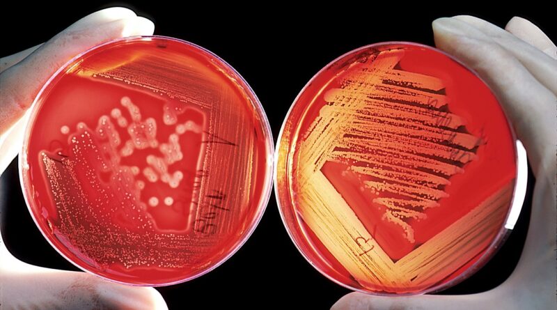 agar, breeding ground, red, blood cells, experiment, research, agar agar, agartang, japanese fish glue, edges, china gelatine, japanese gelatine, carrageenan, polysaccharide, galactose polymer, curd, agarose, agaropektin, biology, science, chemistry, scientists, bacteria, cell growth, medical, germs, bacteria, bacteria, bacteria, bacteria, bacteria